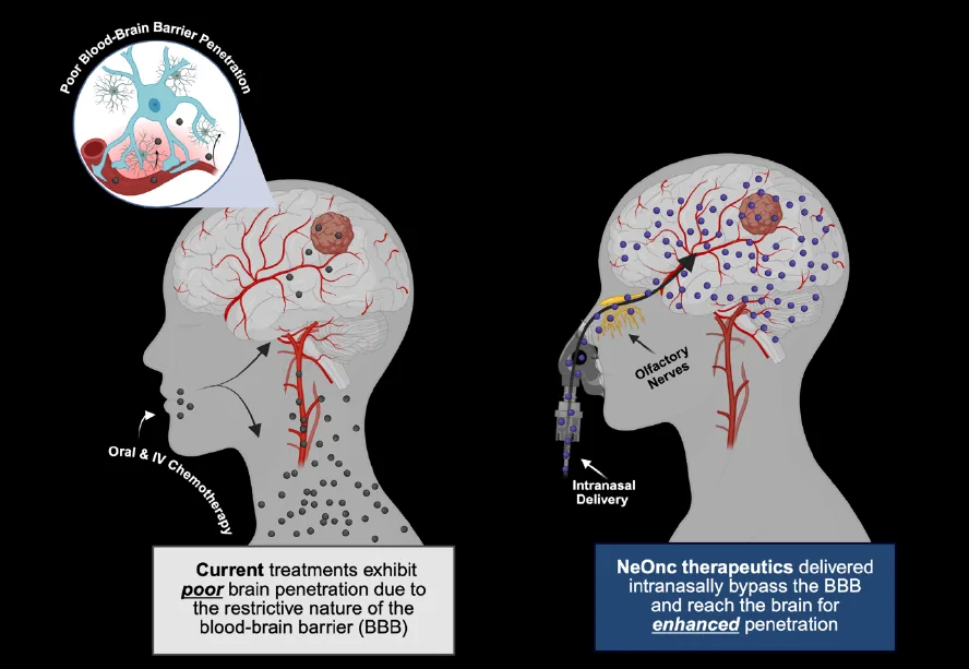 NTHI clinical data trigger and binary outcome